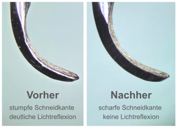 Mikroskopischer Vergleich einer geschärften Kürette und stumpfen Kürette