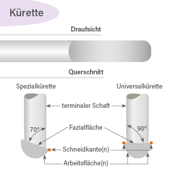 Unterschied zwischen Gracey-Kürette und Universalkürette – Schneidkanten und Form im Vergleich